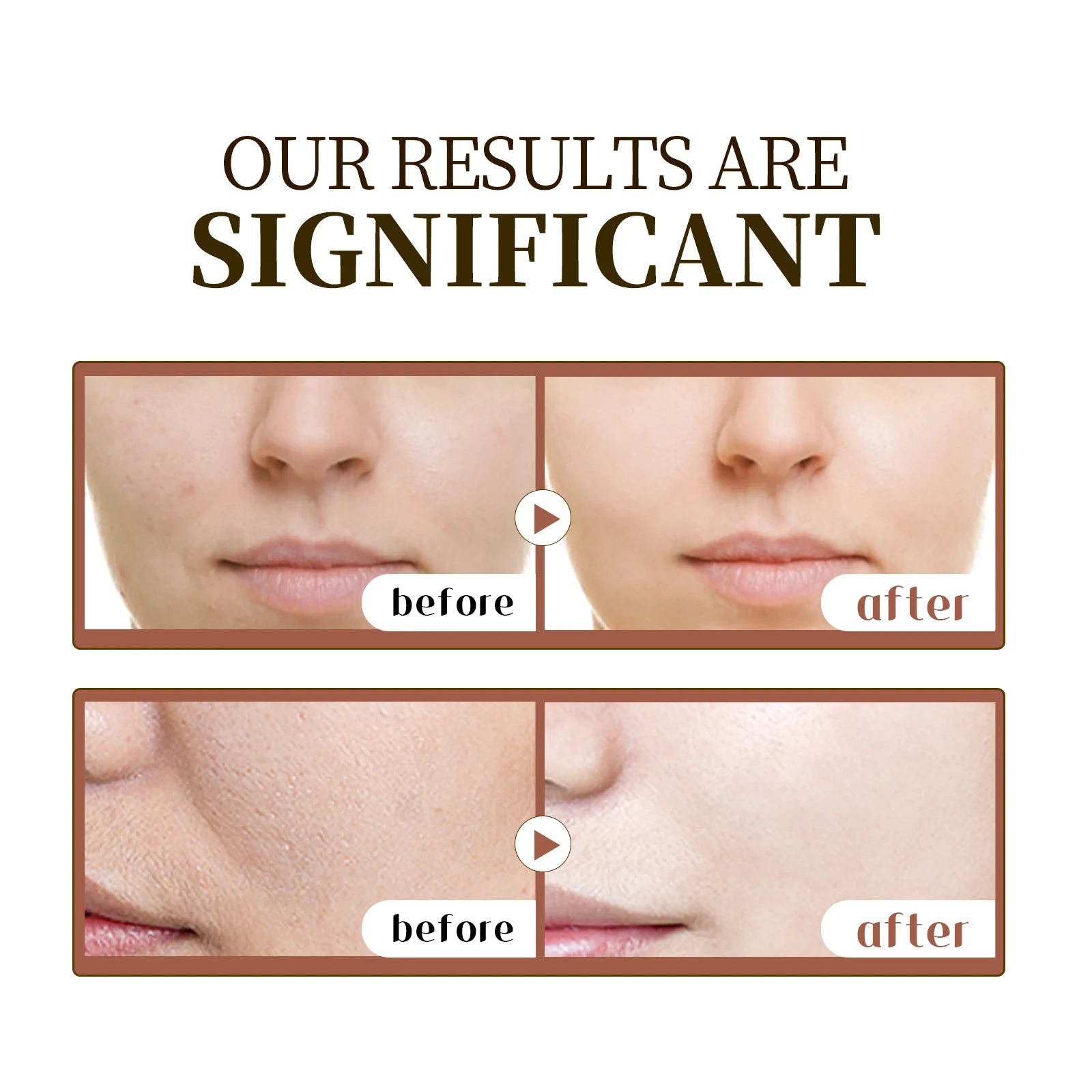 Centella Comfort Serum